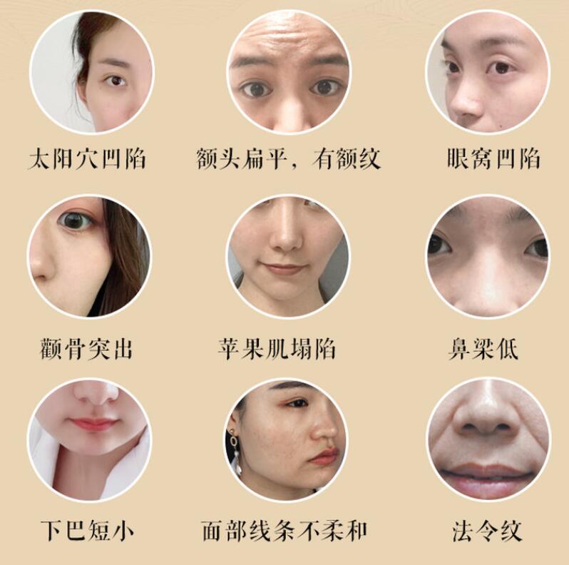 宫廷古方：12节徒手小脸塑颜术牛品源码-源码下载-源码社区-zblog主题插件-PHP源码-三合一源码-直播源码-短视频源码-APP源码-即时通讯-源码-交友源码牛品源码网